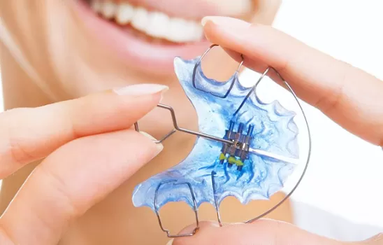 Ağız İçi Sabit Apareyler