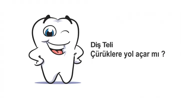 Diş Teli Çürüklere Yol Açar Mı?