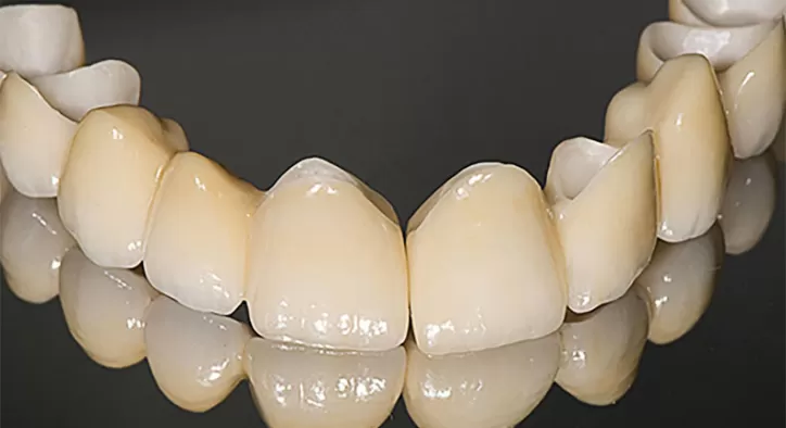 Tam Seramik Kaplamalar