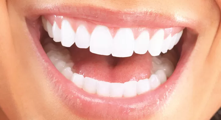 Lamina Porselen Kaplama