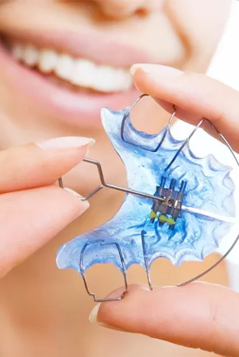 Ağız İçi Sabit Apareyler