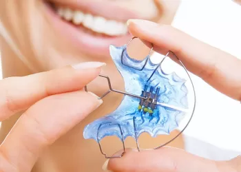 Ağız İçi Sabit Apareyler