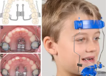 Çeneleri İlgilendiren Ortodontik Anomaliler