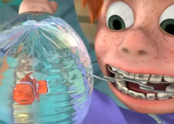 Diş Teli Tedavisinden Sonra Dişler Tekrar Bozulur Mu?