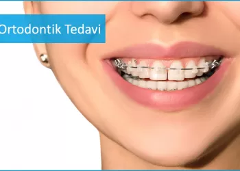 Ortodontik Tedavi