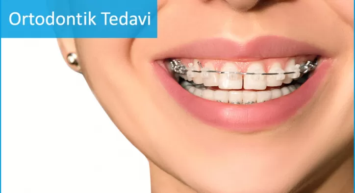 Ortodontik Tedavi