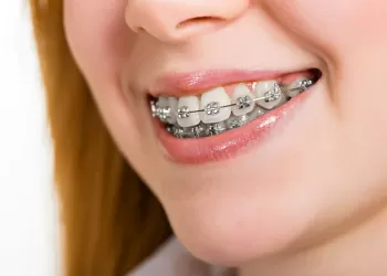 Ortodontik Tedavi Sonuçlandırma