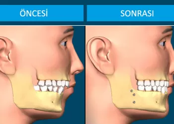 Ortognatik Ortodonti