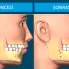Ortognatik Ortodonti