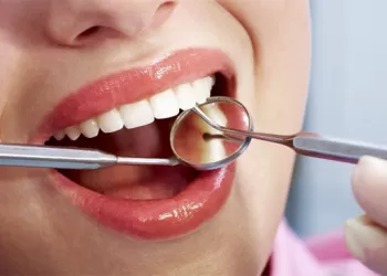 Plastik Periodontal Tedavi