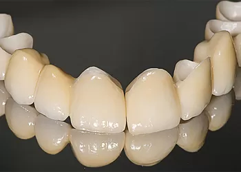 Tam Seramik Kaplamalar