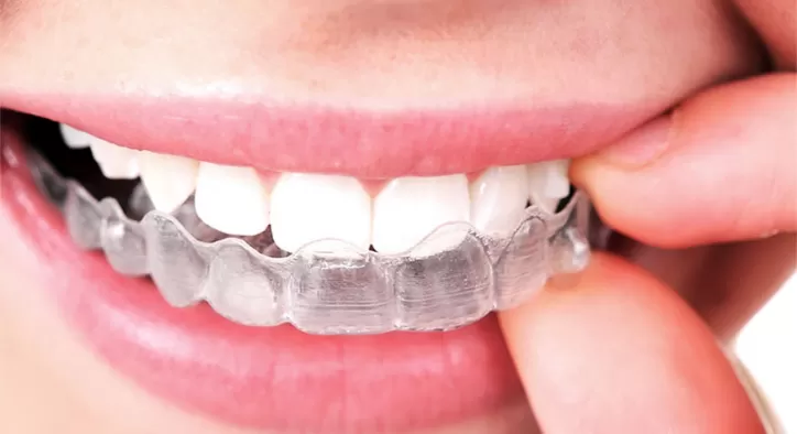 Telsiz Ortodonti Tedavisi Var Mıdır?